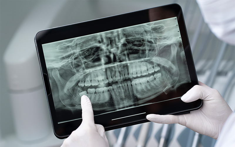 Dentist pointing at a dental x-ray on digital tablet